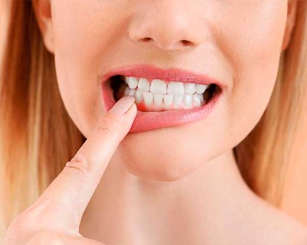 Tratamientos periodentales en Clínica Dental Vallecas