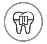 Ortodoncia para niños y adultos en Clínica Dental Vallecas