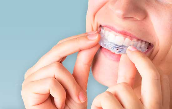 Promo Limpieza + Blanqueamiento dental en Clínica Dental Vallecas. Pasos