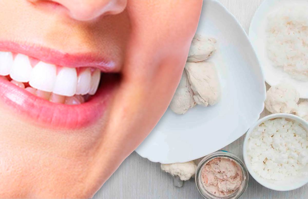 Dieta blanca: qué comer después de un blanqueamiento dental